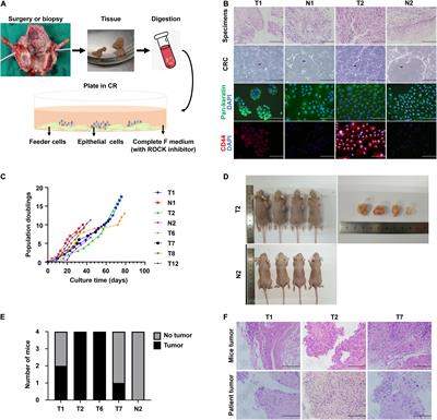 Preclinical Application of Conditional Reprogramming Culture System for Laryngeal and Hypopharyngeal Carcinoma